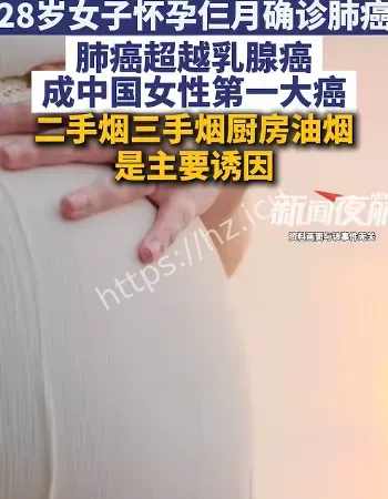 女性第一大癌症